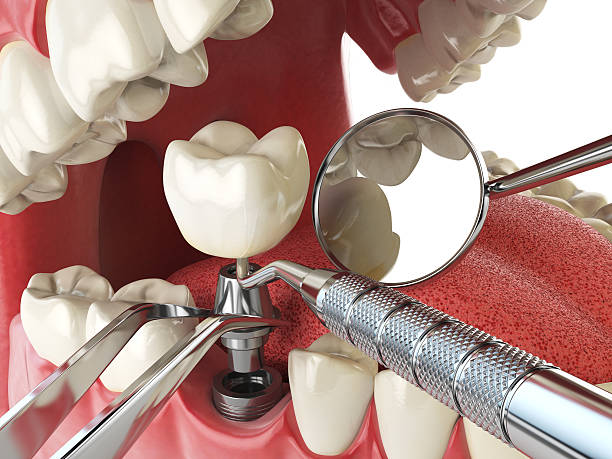 Best Weekend Emergency Dentist in Cascades, VA